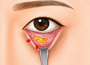 디자인